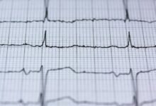 apex pulse market node